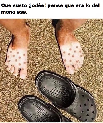 Virus del mono.jpeg